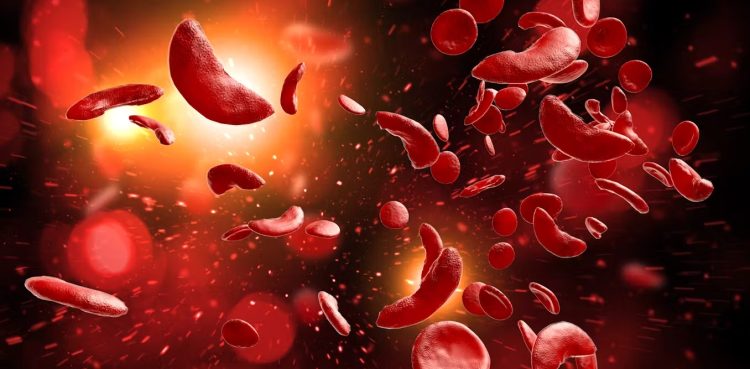 Know Your Sickle Cell Status: Empowering Health Choices for a Better Life